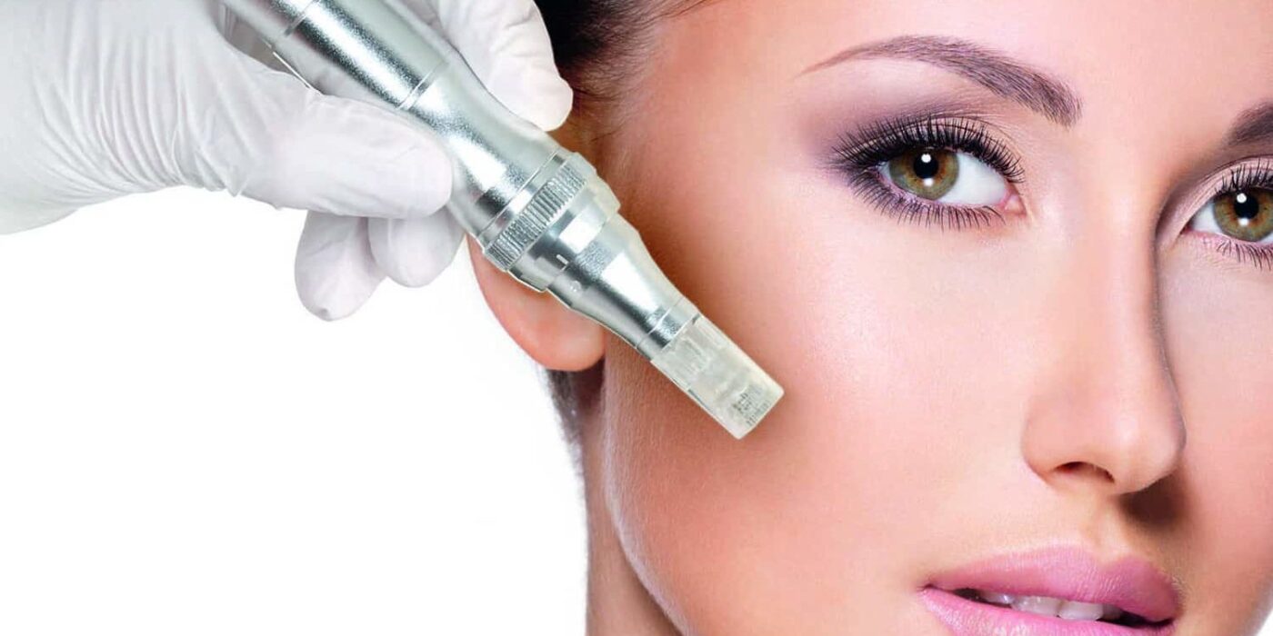 MICRONEEDLING CON DERMAPEN: A COSA SERVE E QUALI BENEFICI COMPORTA?